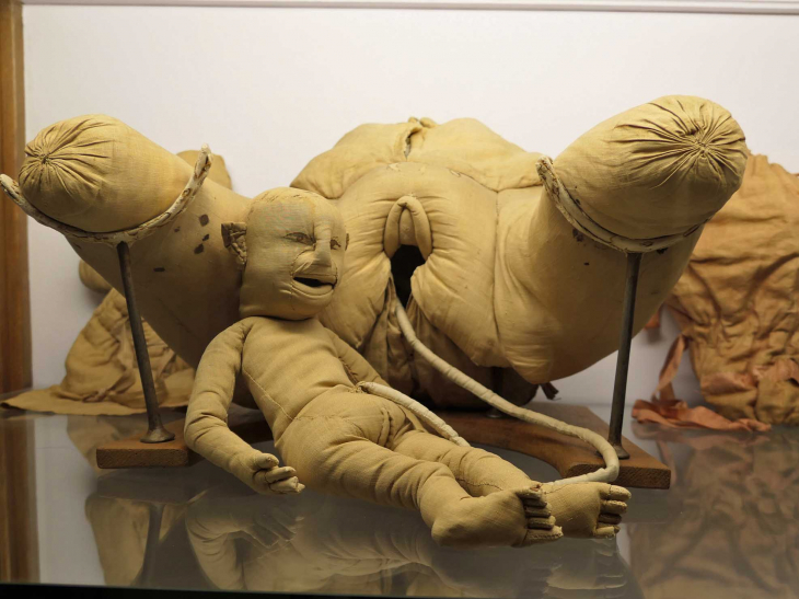 Musée d'Histoire de la Médecine : l'accouchement - Rouen